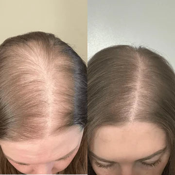 Transformation4