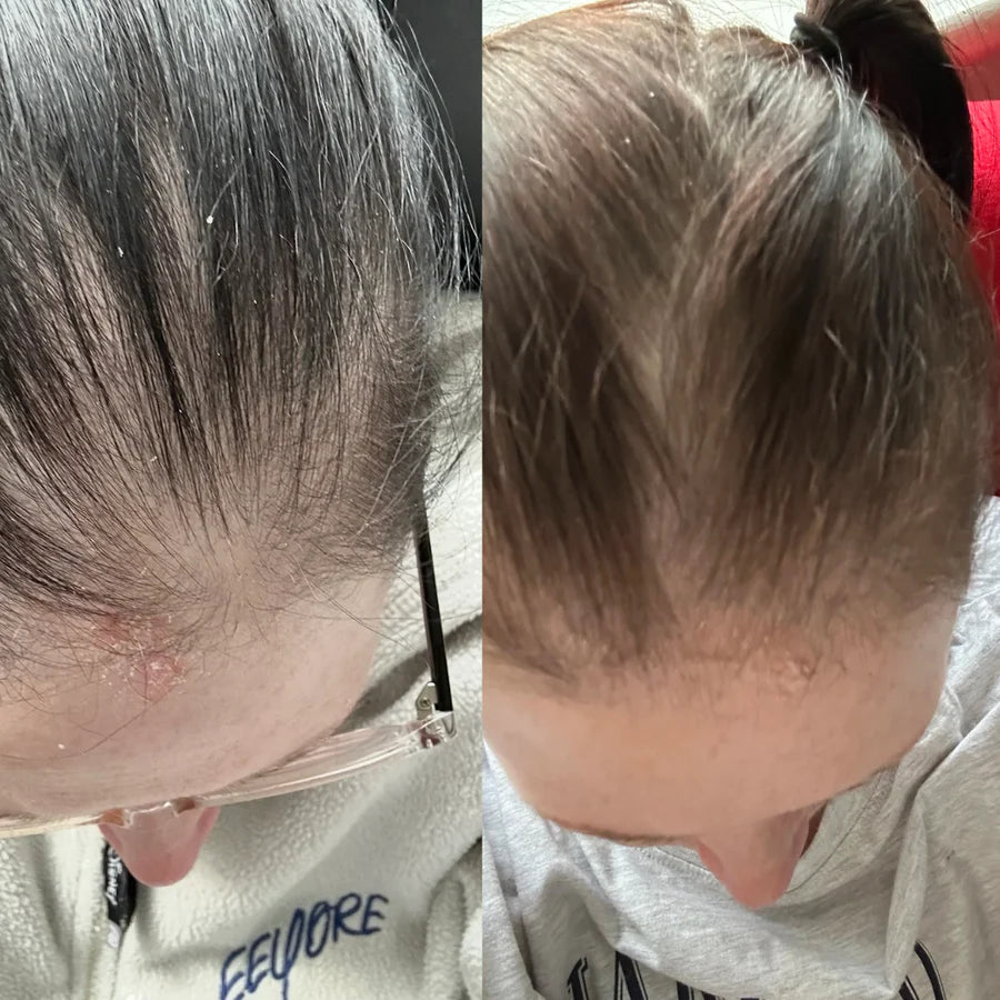 Transformation3