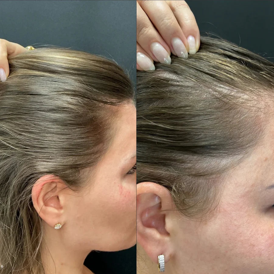 Transformation1