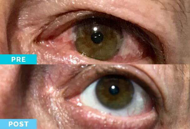 Transformation4
