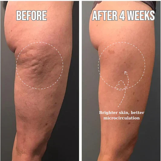 Transformation2
